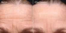 Load image into Gallery viewer, Murad Retinol Youth Renewal Night Cream
