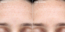 Load image into Gallery viewer, Murad Multi-Vitamin Infusion Oil