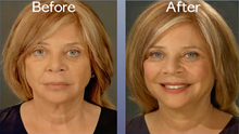 Load image into Gallery viewer, Art Harding's Instant Face and Neck Lift
