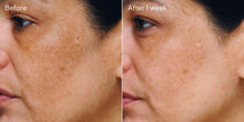 Load image into Gallery viewer, Murad Rapid Age Spot &amp; Pigment Lightening Gel
